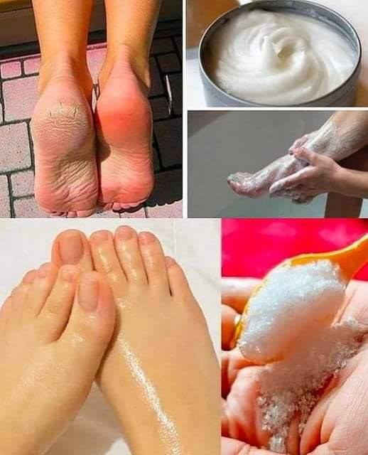 Heres How To Make A Pedicure At Home With Sodium Bicarbonate Best